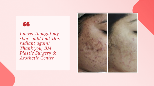 Brown Spot Removal