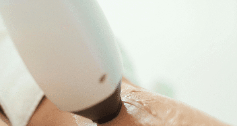 .Best Hair Clinic in Chennai